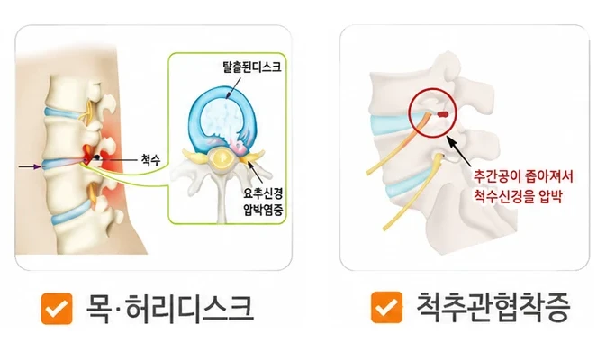 경희미르애한의원 만성통증 대표 질환 — 만성통증·일자목 거북목·목 허리디스크·흉곽출구증후군·척추관협착증