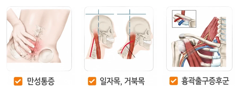 경희미르애한의원 만성통증 대표 질환 — 만성통증·일자목 거북목·목 허리디스크·흉곽출구증후군·척추관협착증