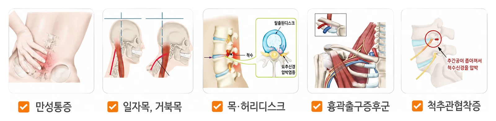 경희미르애한의원 만성통증 대표 질환 — 만성통증·일자목 거북목·목 허리디스크·흉곽출구증후군·척추관협착증