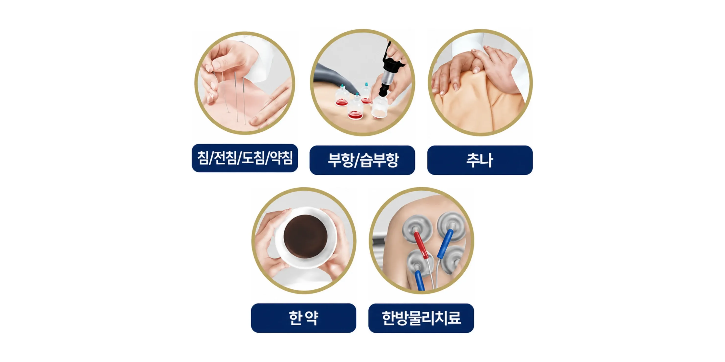 추나 · 약침 · 한약까지 자동차보험으로