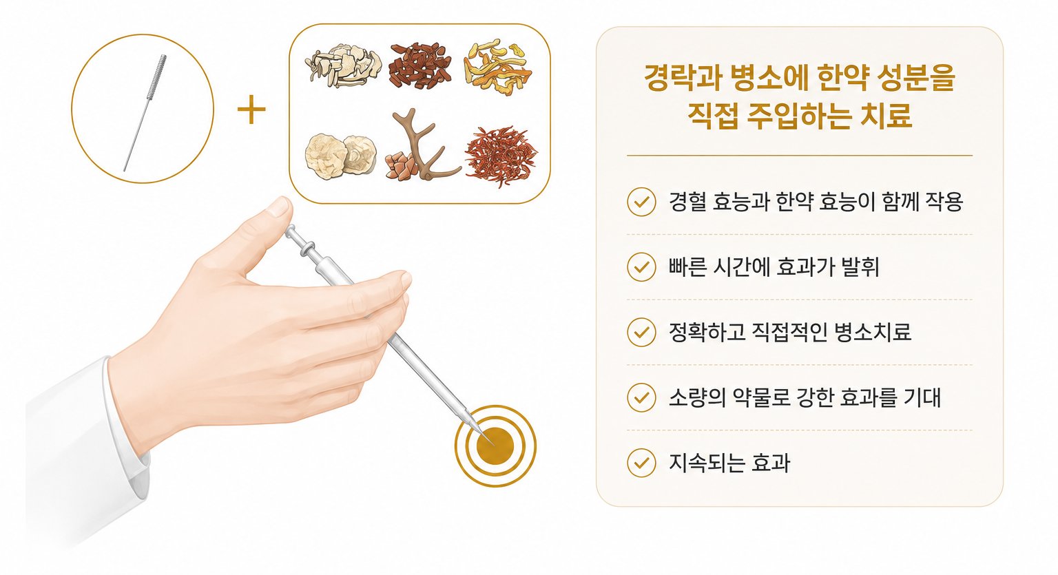 약침치료의 장점 — 경락과 병소에 한약 성분을 직접 주입하는 치료. 경혈 효능과 한약 효능이 함께 작용, 빠른 시간에 효과 발휘, 정확하고 직접적인 병소 치료, 소량의 약물로 강한 효과 기대, 지속되는 효과